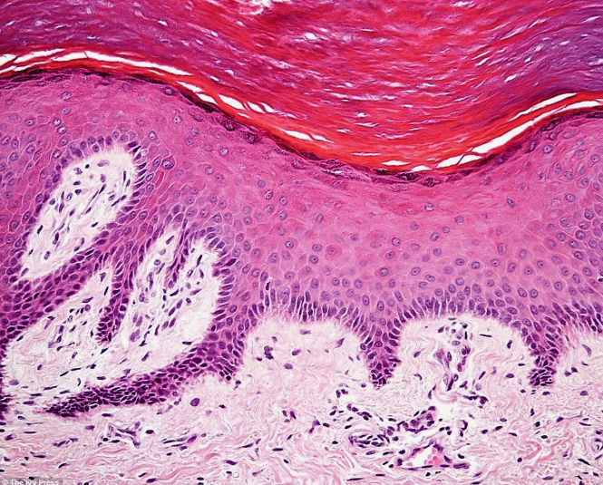 Кожа, микрофото