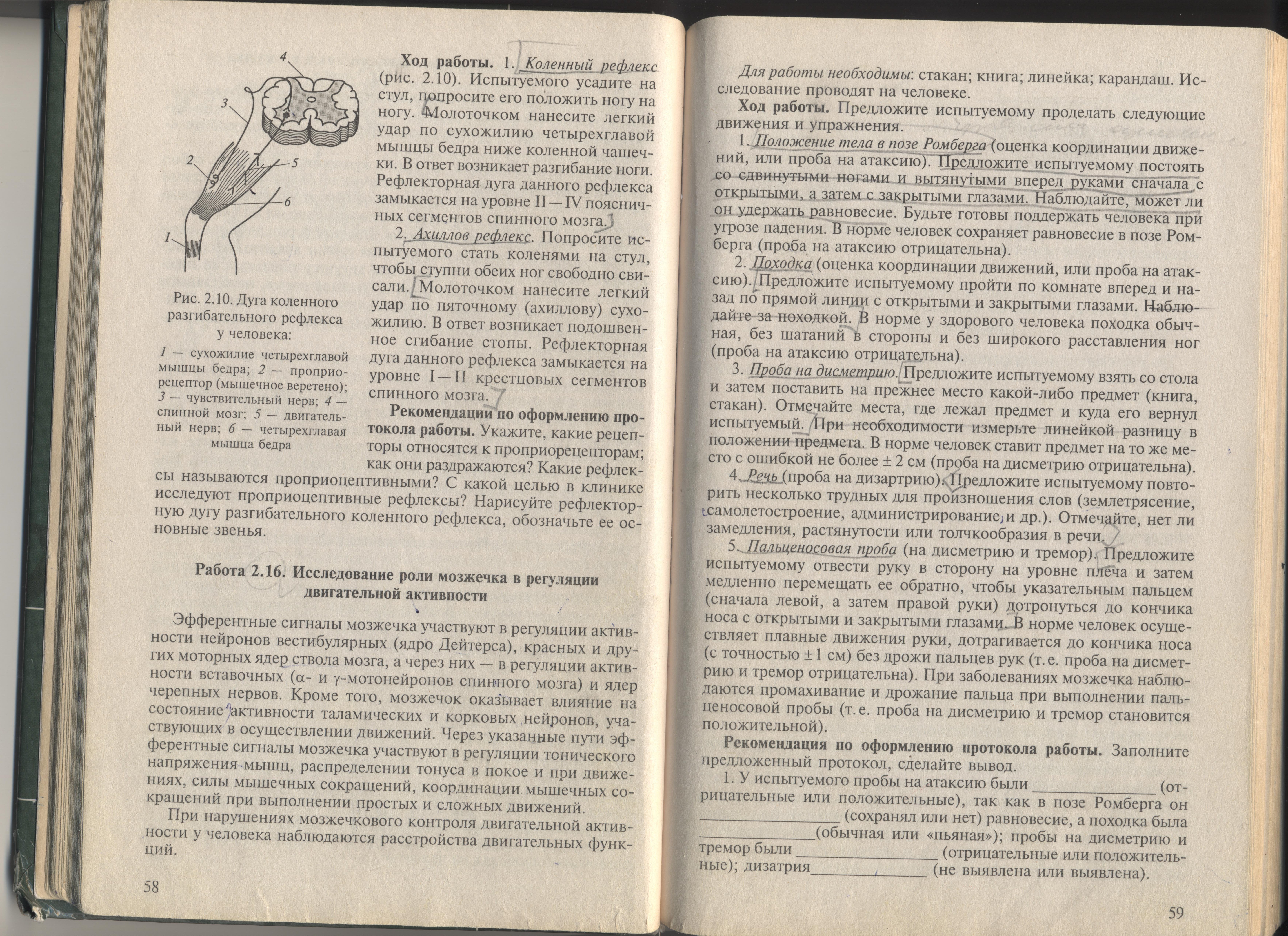 Регистарция ЭЭГ