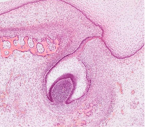 Стадия развития зуба