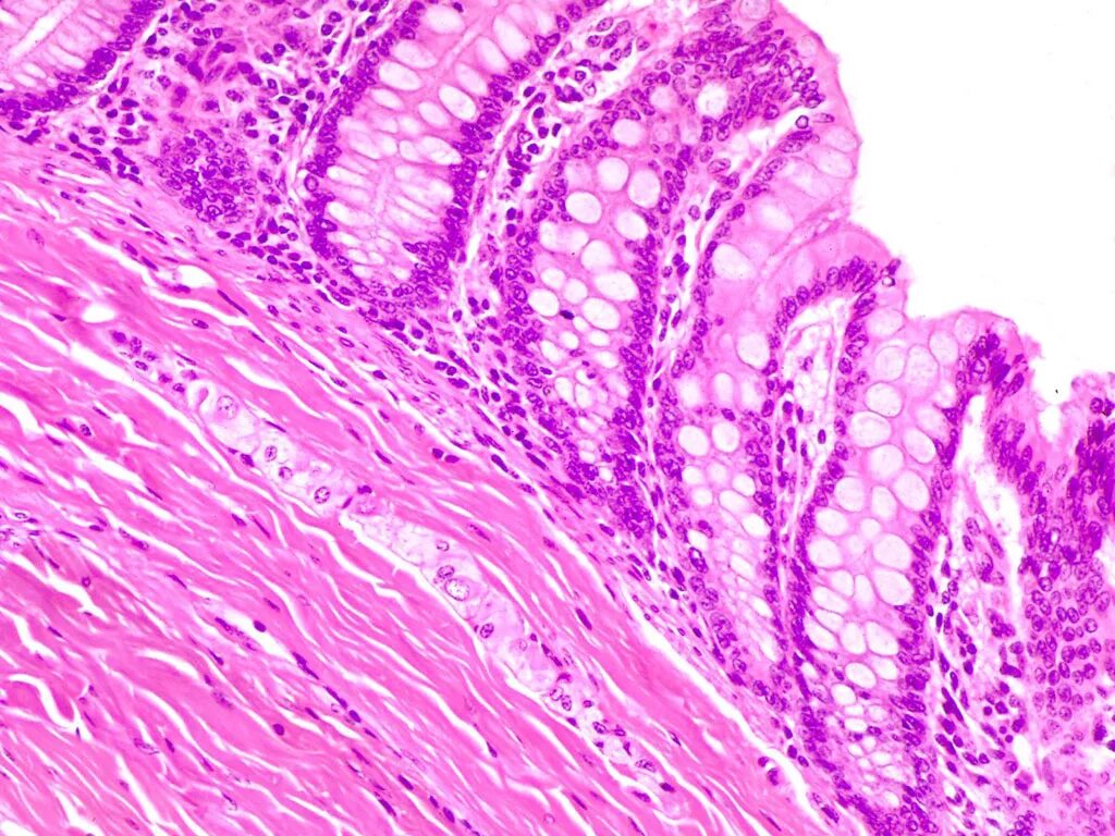 Стенка толстой кишки